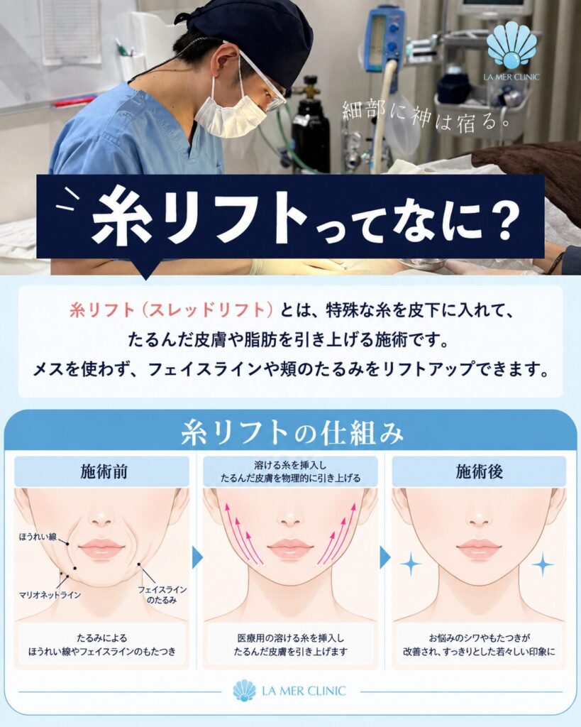 名古屋ラメールクリニックの糸リフト