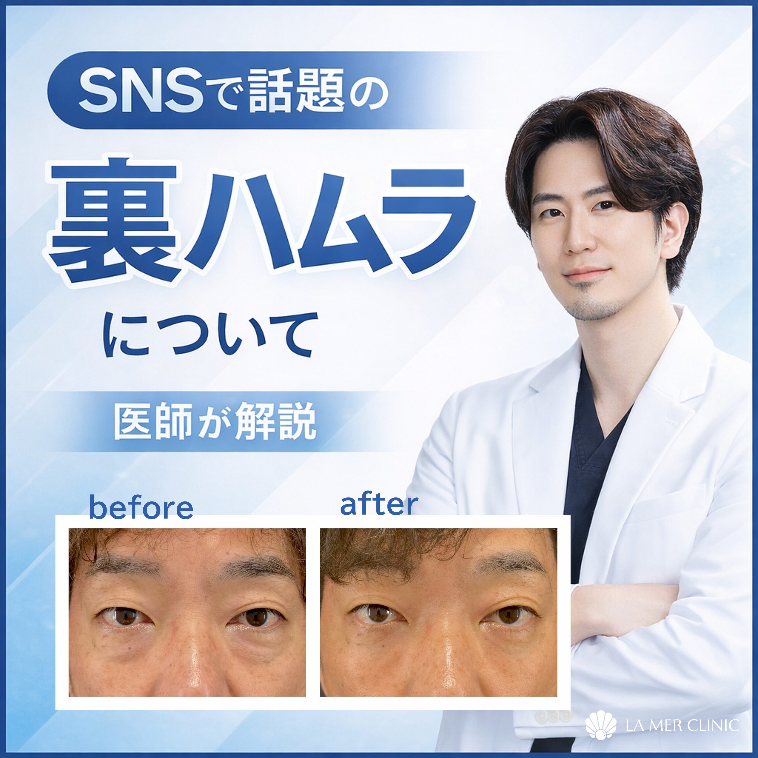 名古屋】裏ハムラ法とは？やるべき人・やらない方がいい人を医師が解説 