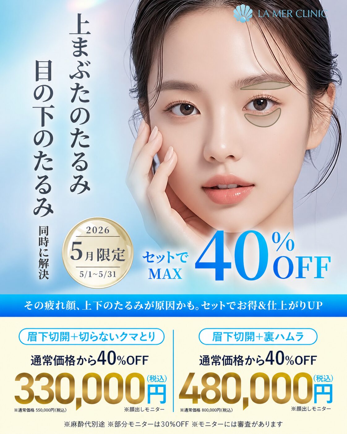 【5月限定】目の下のクマ・たるみ＋眉下切開が最大40％OFF｜名古屋ラメールクリニック