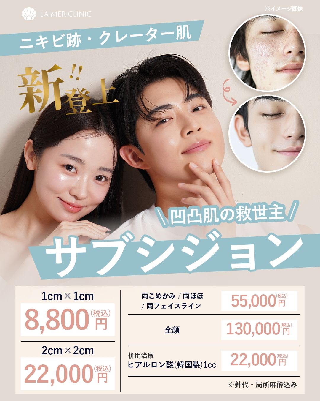 サブシジョンとは？ニキビ跡・クレーター治療の仕組み