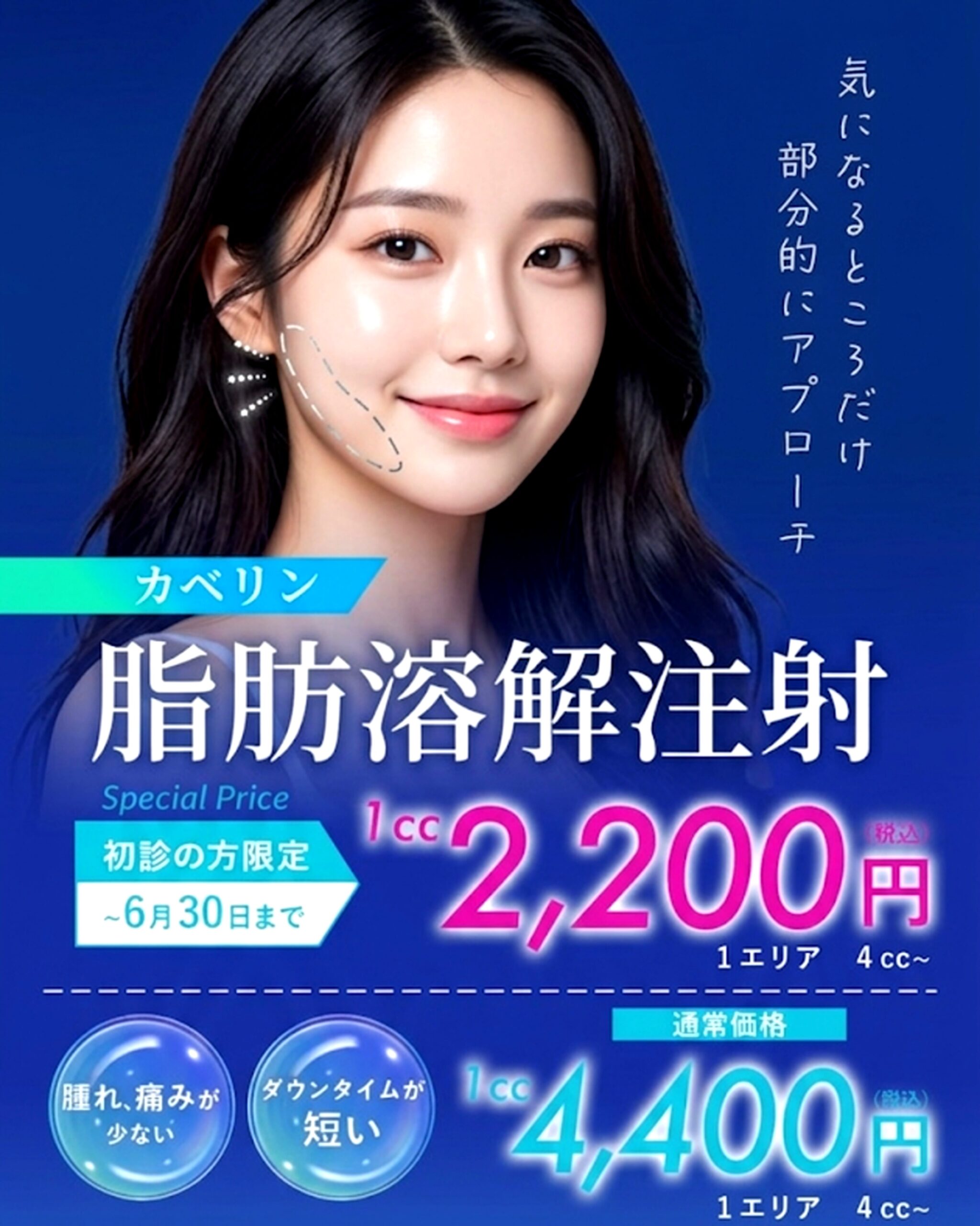 【期間限定】脂肪溶解注射（カベリン）初診キャンペーン｜切らずにすっきり小顔へ