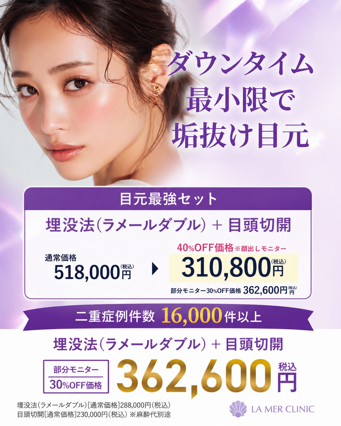 【名古屋】平行二重を目指すなら埋没法＋目頭切開｜ラメールダブル＋目頭切開セット