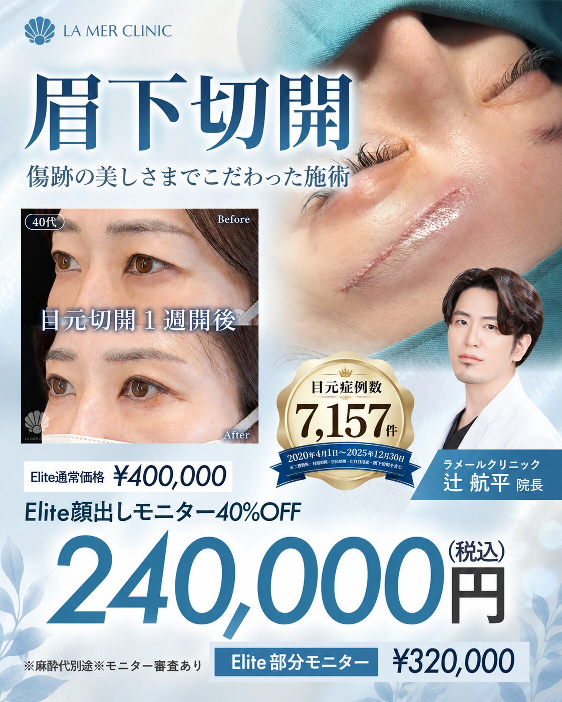 【名古屋】10月の眉下切開はラメールクリニック辻航平院長