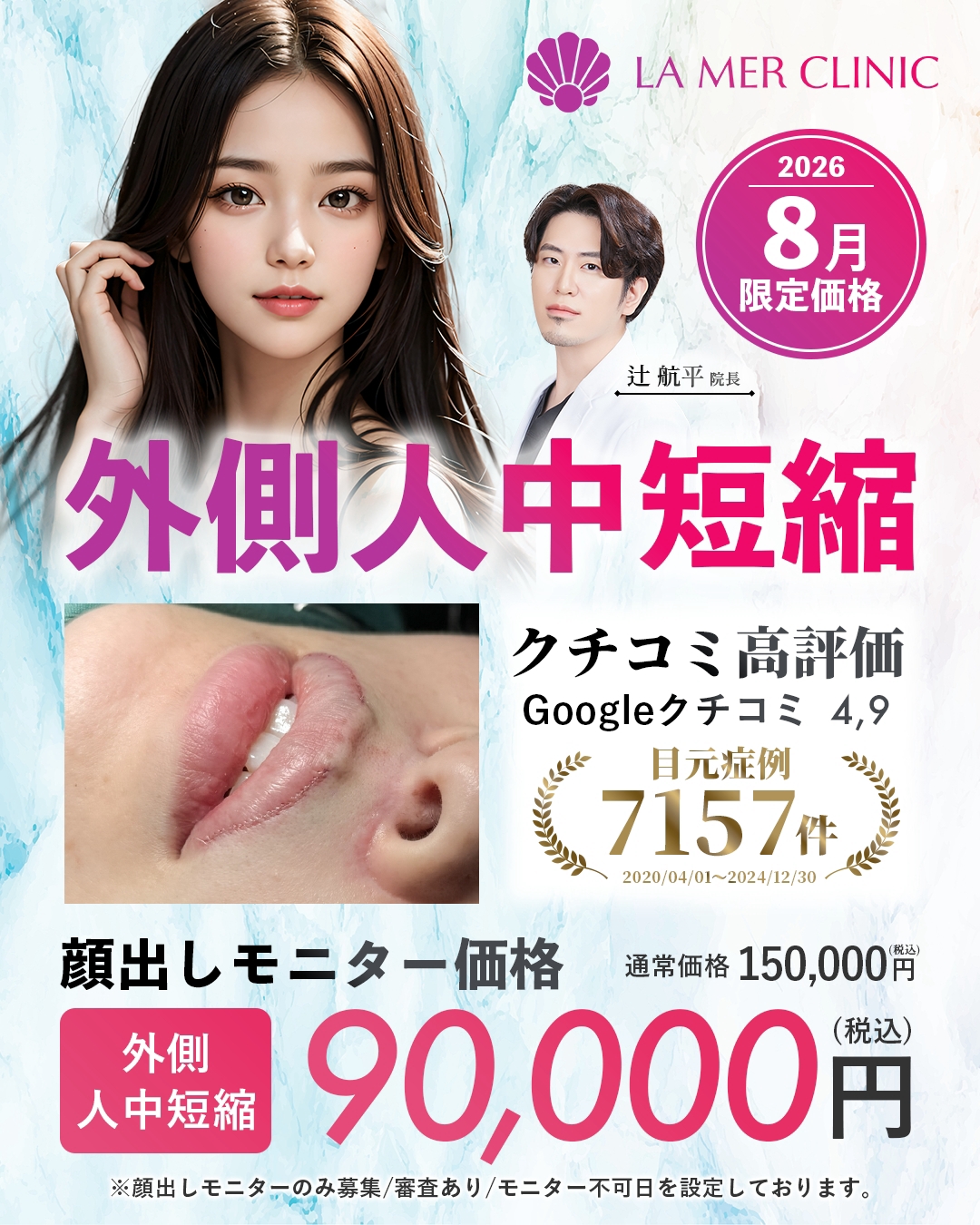 【名古屋】人中短縮・外側人中短縮・口角挙上が安い！