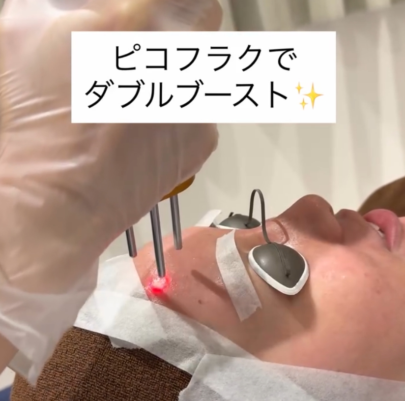 ダブルピコの美肌治療について