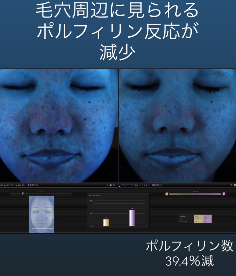 ラメールクリニックの美肌治療