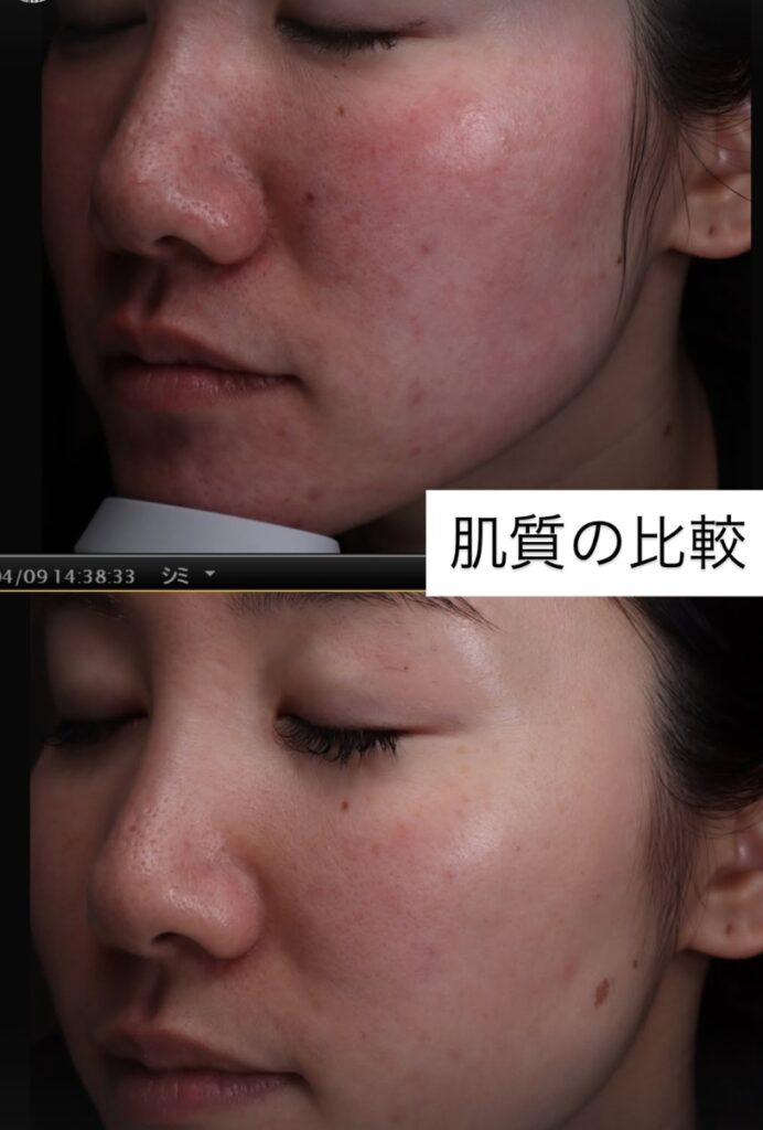 美肌治療がおすすめの方