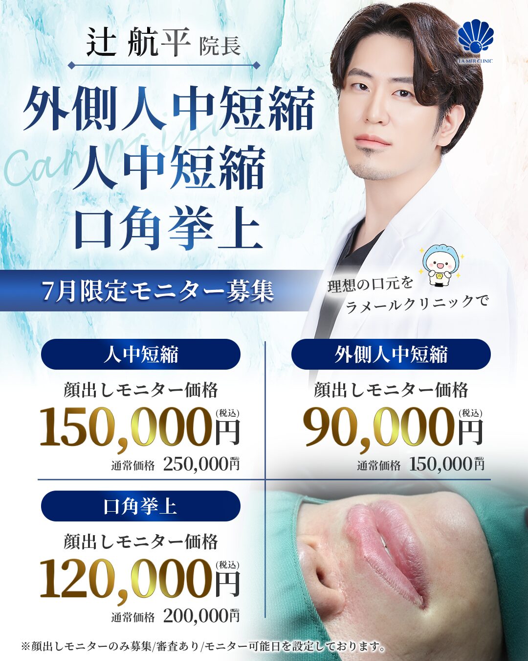 【名古屋】人中短縮・外側人中短縮・口角挙上が安い！