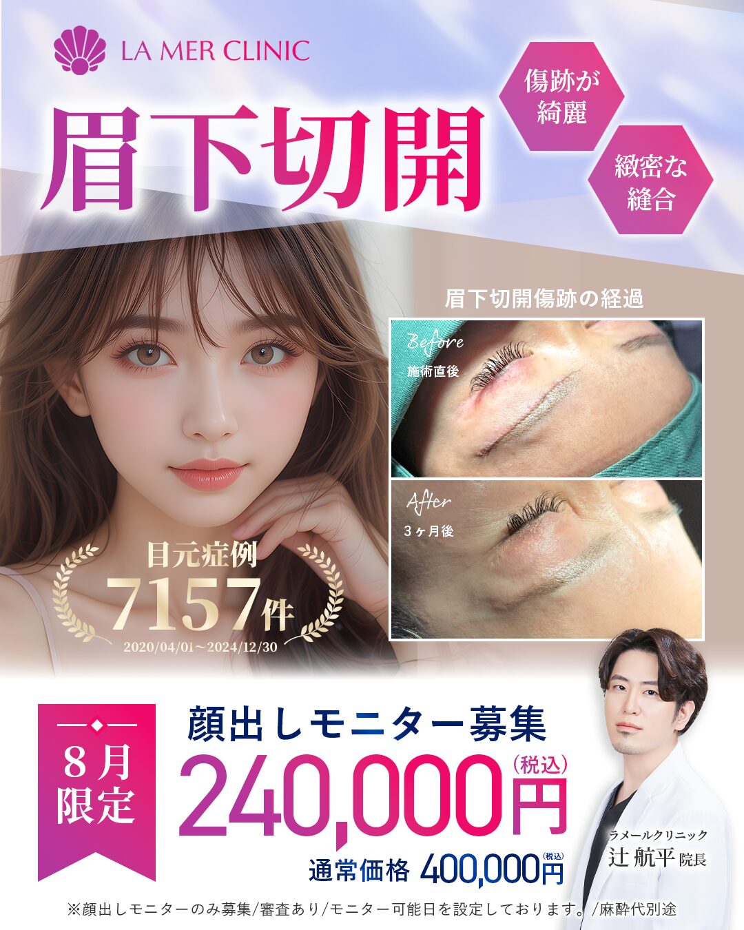 【名古屋】眉下切開が安い！