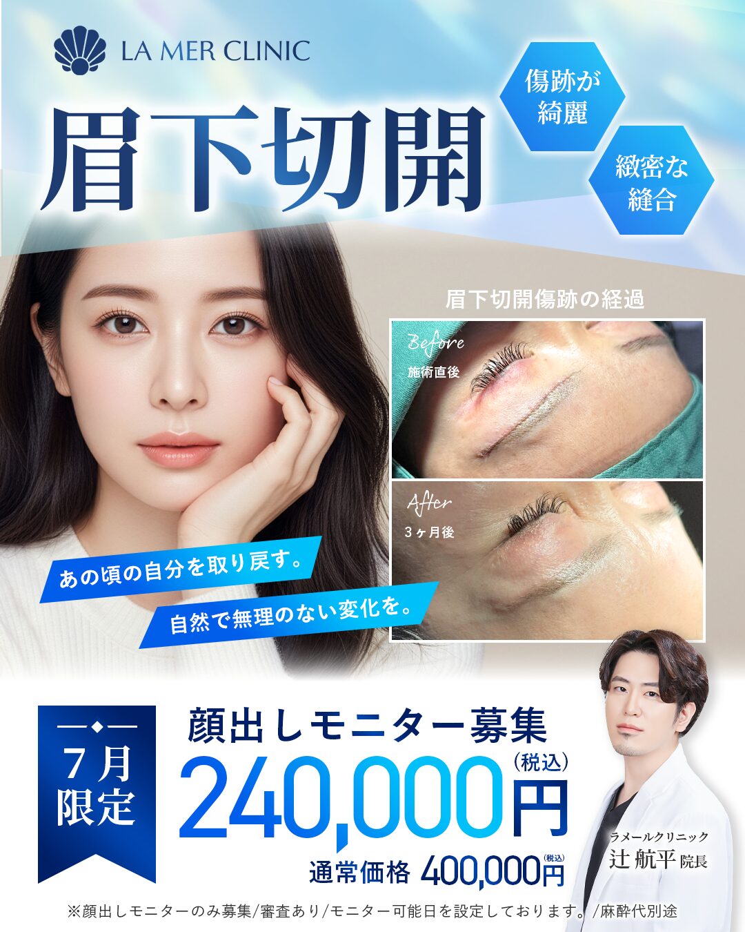 【名古屋】眉下切開が安い！