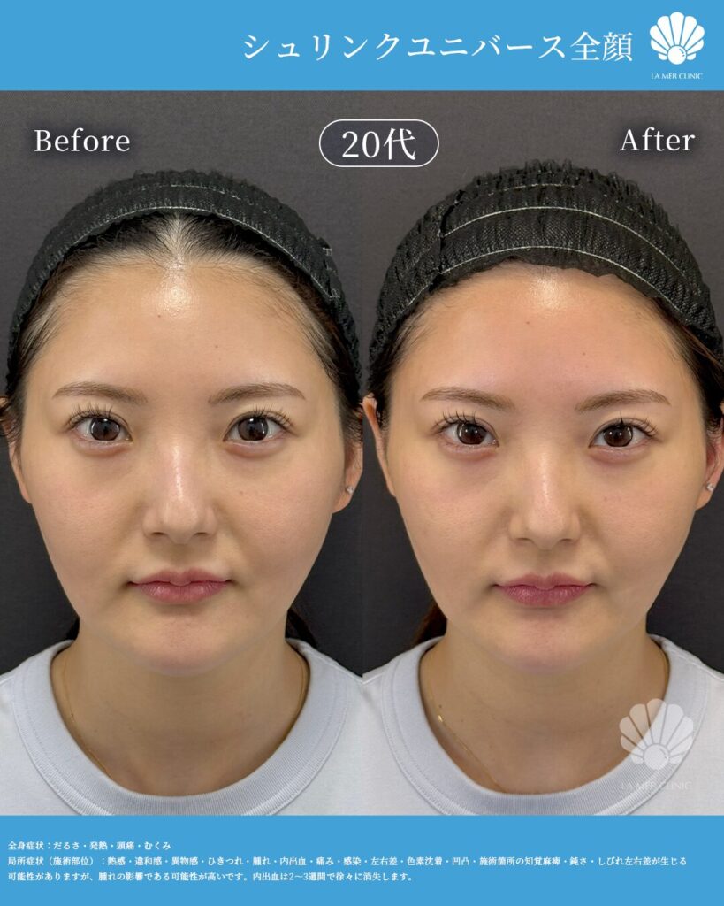 よっぴの美容医療体験写真1