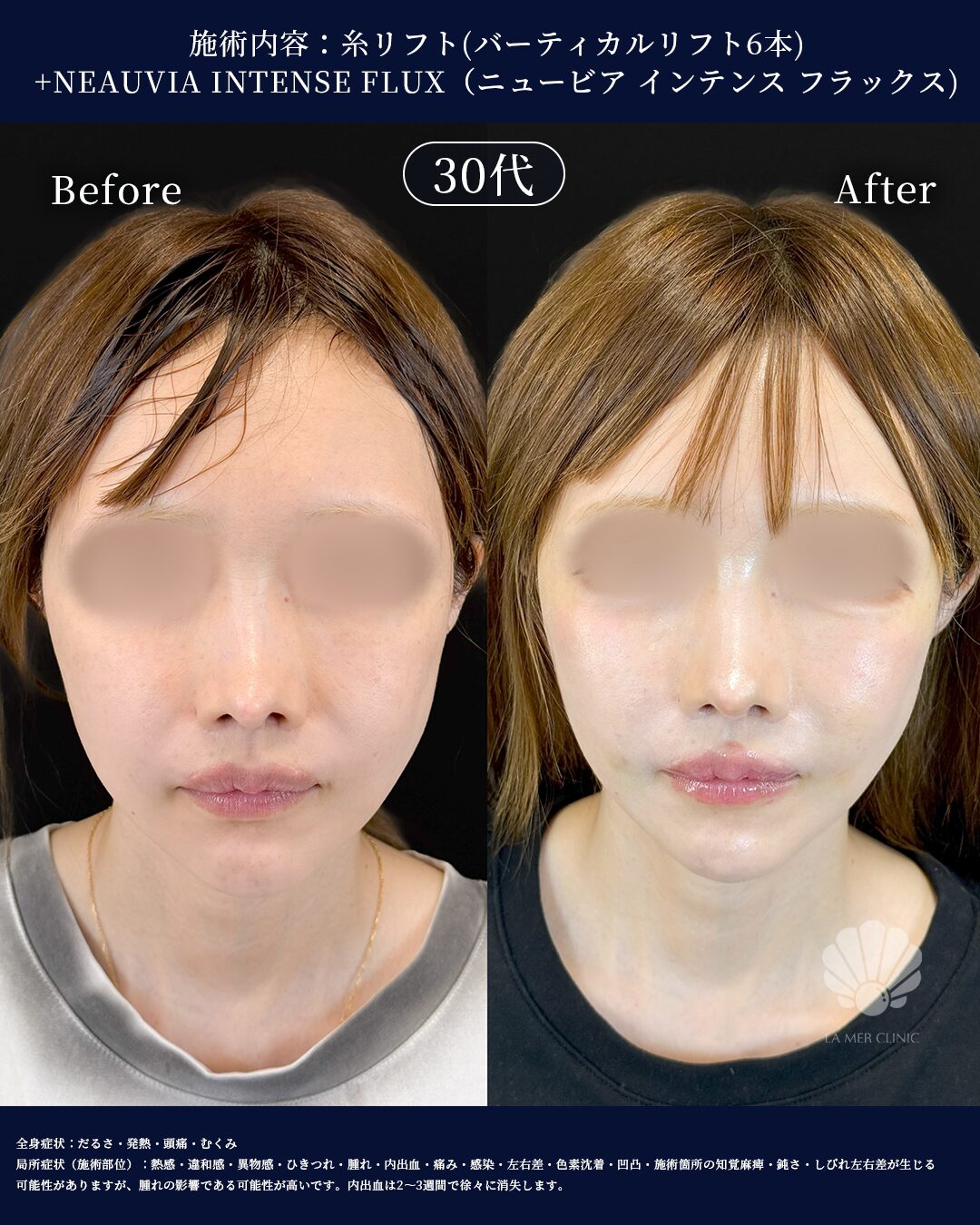 https://la-mer-clinic.jp/wp/wp-content/uploads/2026/09/3252300１ｗｐｈ.jpg