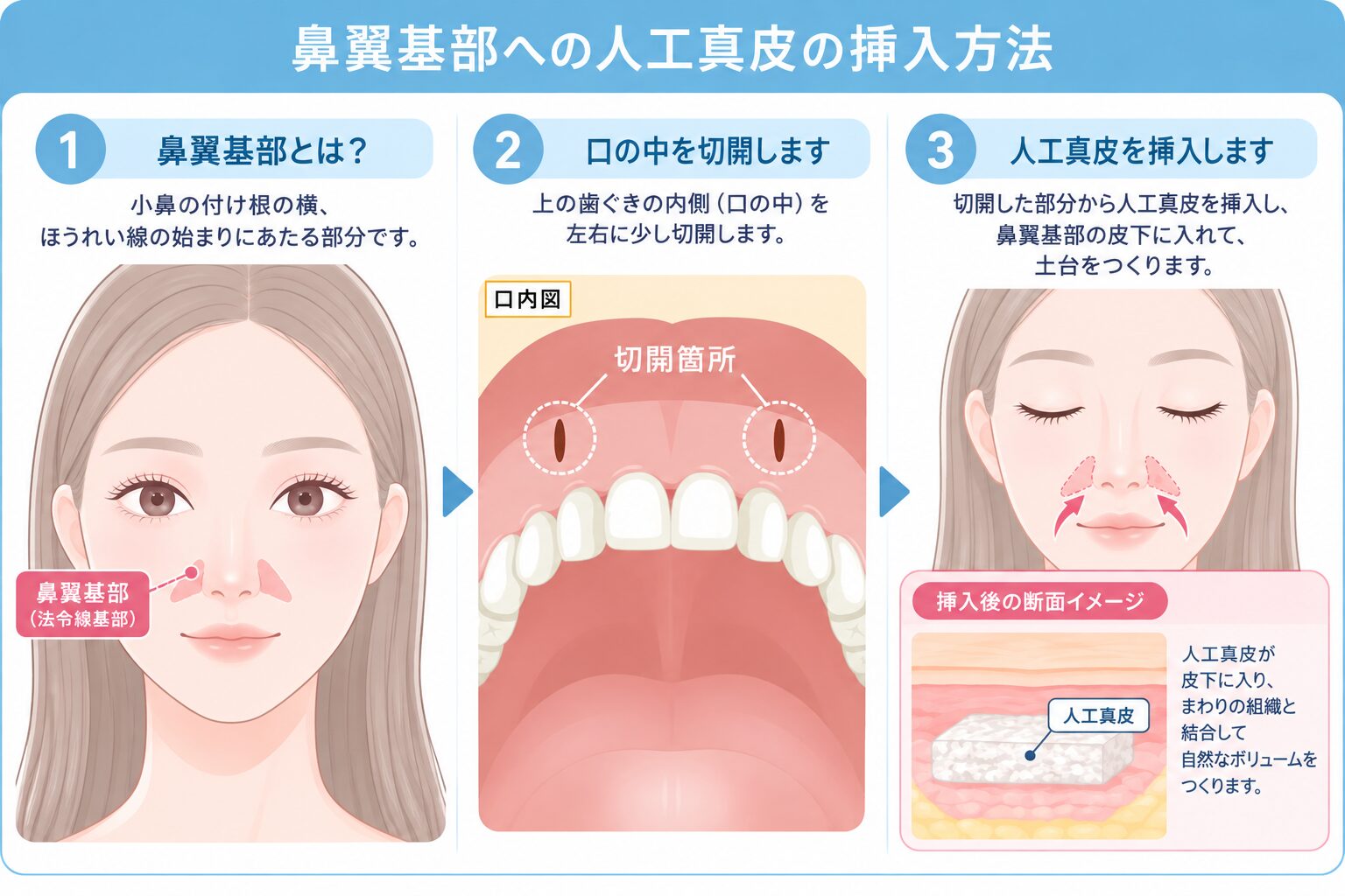 人工真皮の構造