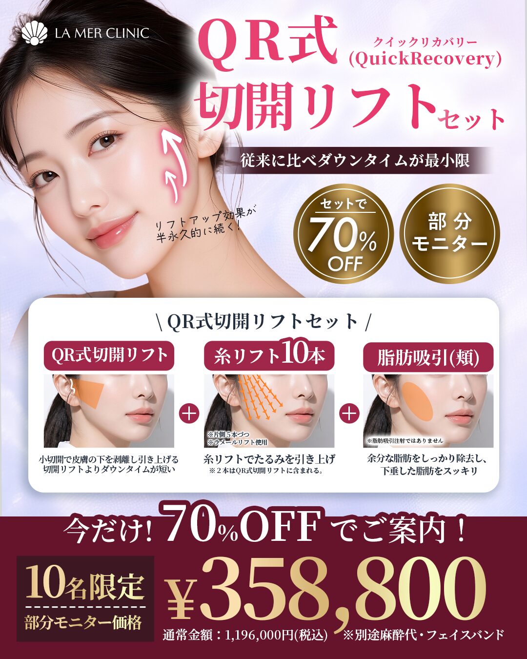 QR式切開リフト70％OFFキャンペーン