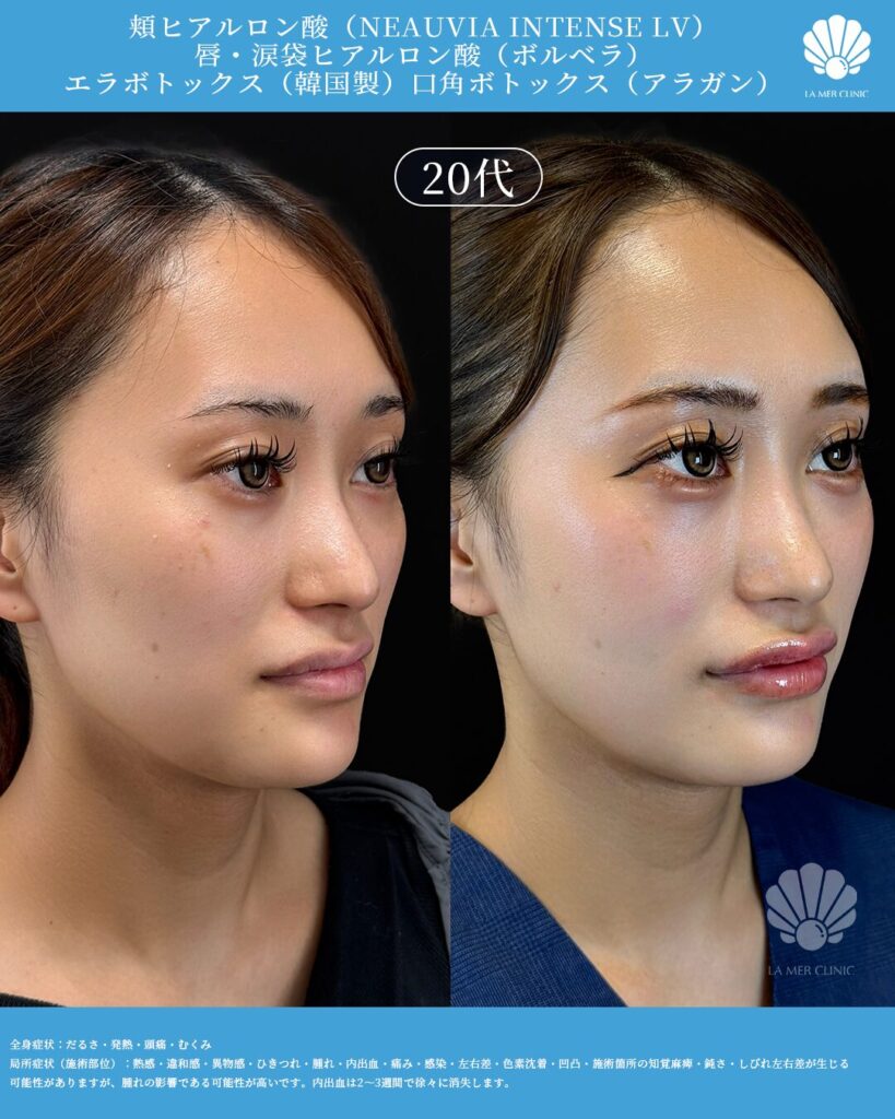 ぺぺちの美容医療に関する写真2