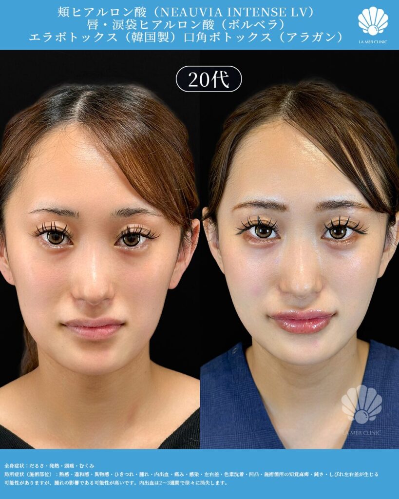 ぺぺちの美容医療に関する写真1