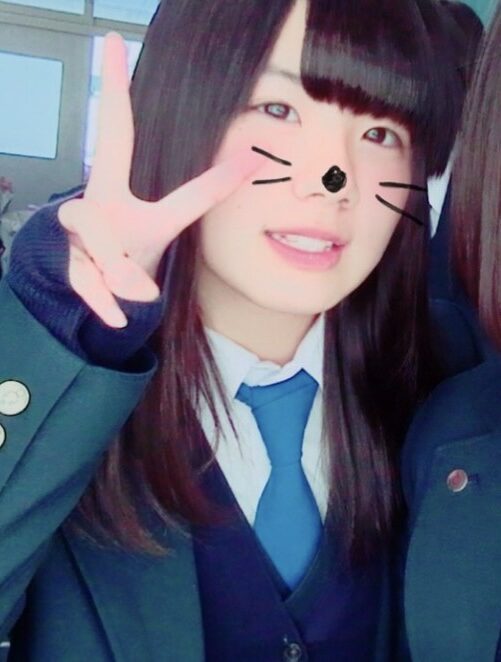 二重埋没と目頭切開に関する写真1