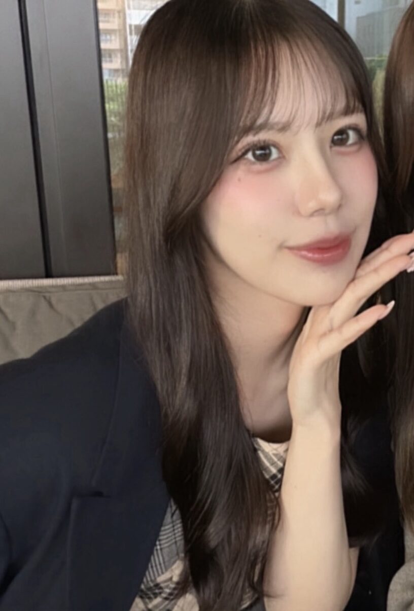 二重埋没と目頭切開に関する写真2