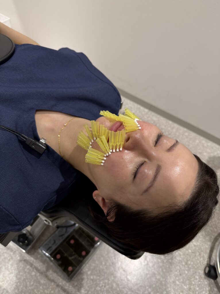 あいこの美容医療体験写真1