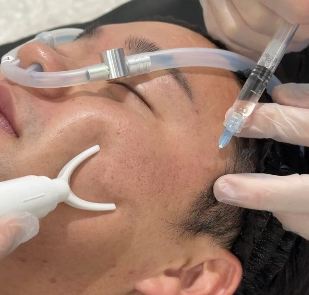 LA MER CLINICのプルリアル治療