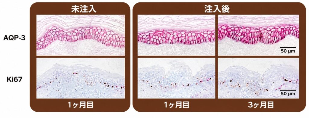 AQP3の1か月目と3か月目の変化