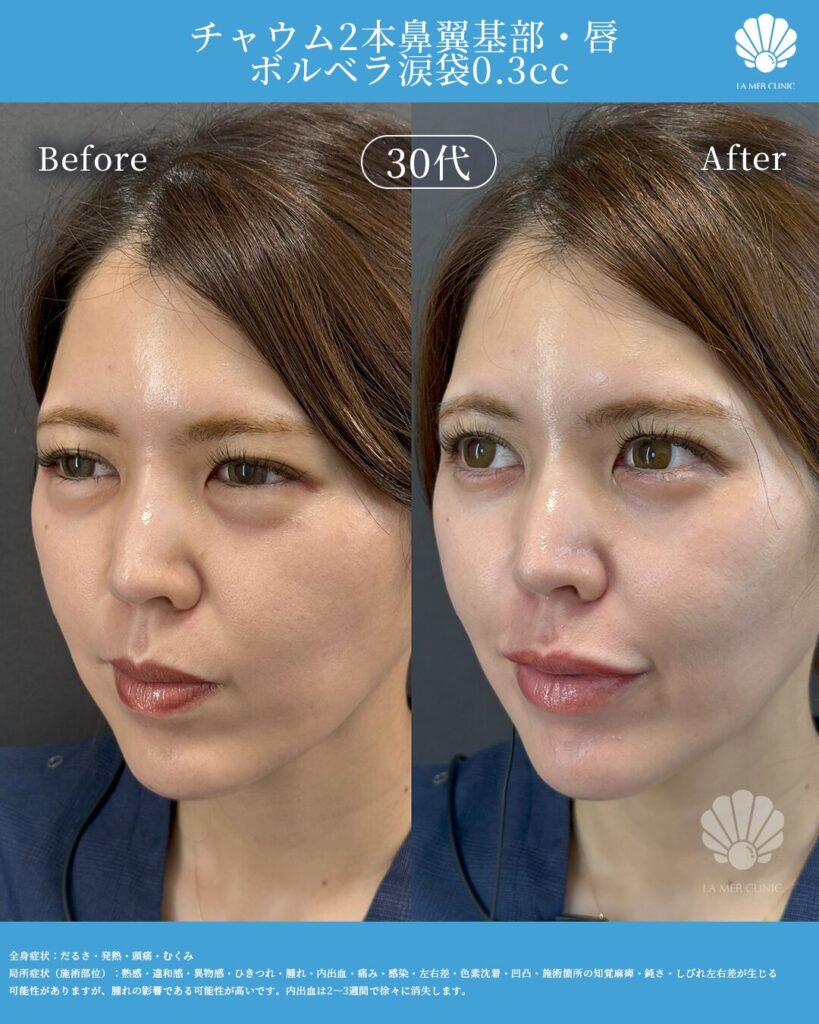 美容医療の写真5