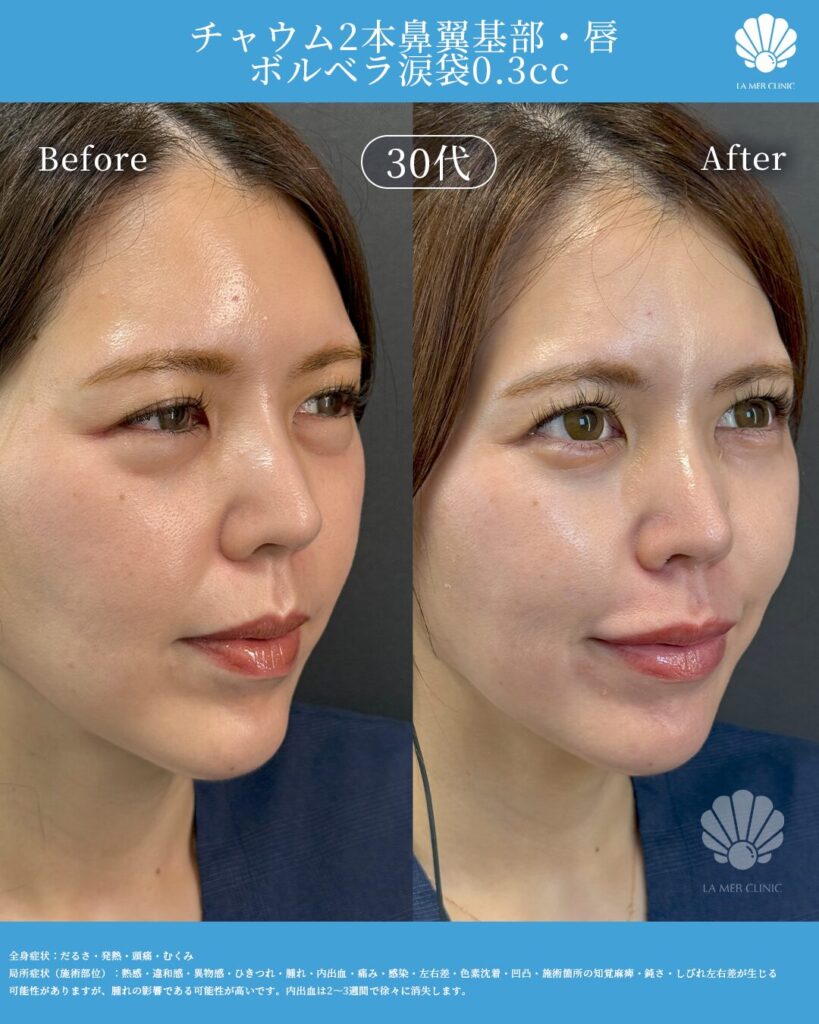 美容医療の写真2