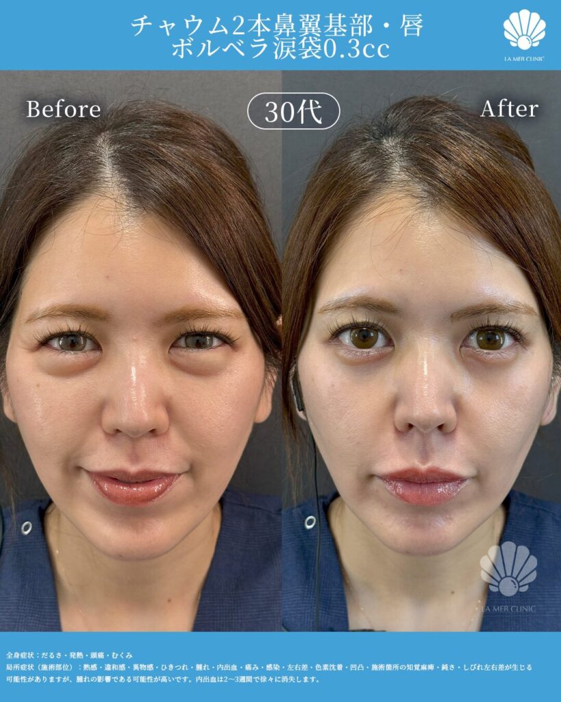 美容医療の写真4