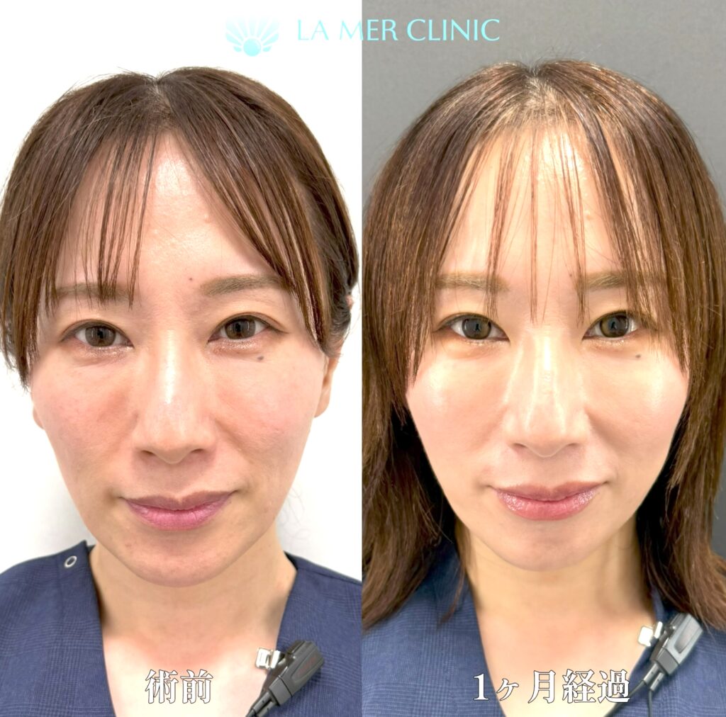 美容看護師としての仕事
