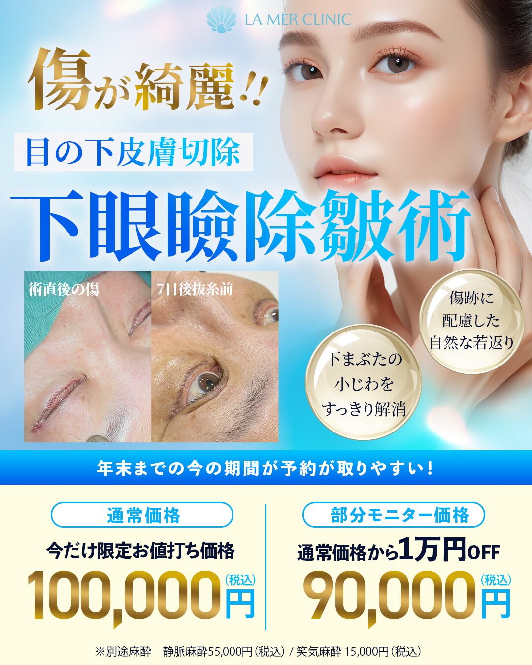 名古屋の目の下のたるみ取り・下眼瞼除皺術｜モニター価格9万円【LA MER CLINIC】